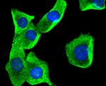 AKAP14 Antibody in Immunocytochemistry (ICC/IF)