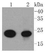 AKAP14 Antibody in Western Blot (WB)