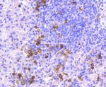 CD14 Antibody in Immunohistochemistry (Paraffin) (IHC (P))