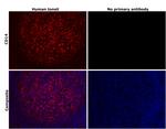 CD14 Antibody in Immunohistochemistry (Paraffin) (IHC (P))