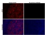 CD14 Antibody in Immunohistochemistry (Paraffin) (IHC (P))