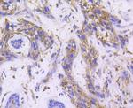 RALBP1 Antibody in Immunohistochemistry (Paraffin) (IHC (P))