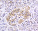 RALBP1 Antibody in Immunohistochemistry (Paraffin) (IHC (P))