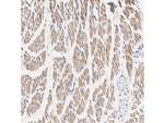 Phospho-HSL (Ser853) Antibody in Immunohistochemistry (Paraffin) (IHC (P))