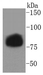 Phospho-HSL (Ser853) Antibody in Western Blot (WB)