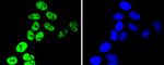 hnRNP C1/C2 Antibody in Immunocytochemistry (ICC/IF)