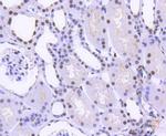 hnRNP C1/C2 Antibody in Immunohistochemistry (Paraffin) (IHC (P))