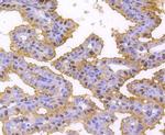 hnRNP C1/C2 Antibody in Immunohistochemistry (Paraffin) (IHC (P))