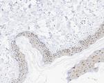 Phospho-c-Myc (Thr58) Antibody in Immunohistochemistry (Paraffin) (IHC (P))