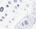 Phospho-c-Myc (Thr58) Antibody in Immunohistochemistry (Paraffin) (IHC (P))