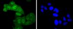 Phospho-c-Myc (Thr58) Antibody in Immunocytochemistry (ICC/IF)