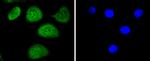 Phospho-c-Myc (Thr58) Antibody in Immunocytochemistry (ICC/IF)