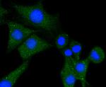 PLCG1 Antibody in Immunocytochemistry (ICC/IF)