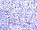 CD103 (Integrin alpha E) Antibody in Immunohistochemistry (Paraffin) (IHC (P))