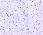 P-Glycoprotein Antibody in Immunohistochemistry (Paraffin) (IHC (P))