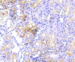 P-Glycoprotein Antibody in Immunohistochemistry (Paraffin) (IHC (P))