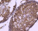 RAD18 Antibody in Immunohistochemistry (Paraffin) (IHC (P))