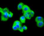 MMP11 Antibody in Immunocytochemistry (ICC/IF)