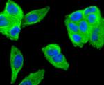 MMP11 Antibody in Immunocytochemistry (ICC/IF)