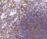 MMP11 Antibody in Immunohistochemistry (Paraffin) (IHC (P))