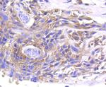 MMP11 Antibody in Immunohistochemistry (Paraffin) (IHC (P))