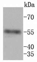 MMP11 Antibody in Western Blot (WB)