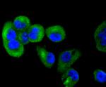 TACC3 Antibody in Immunocytochemistry (ICC/IF)