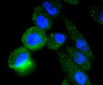 TACC3 Antibody in Immunocytochemistry (ICC/IF)