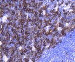 TACC3 Antibody in Immunohistochemistry (Paraffin) (IHC (P))