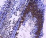 TACC3 Antibody in Immunohistochemistry (Paraffin) (IHC (P))