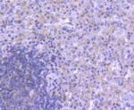 ATG5 Antibody in Immunohistochemistry (Paraffin) (IHC (P))