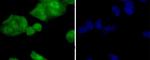 PP2A alpha/beta Antibody in Immunocytochemistry (ICC/IF)