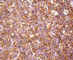 PP2A alpha/beta Antibody in Immunohistochemistry (Paraffin) (IHC (P))