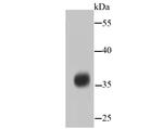 PP2A alpha/beta Antibody in Western Blot (WB)