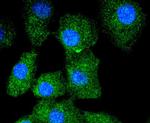 Cytokeratin 13 Antibody in Immunocytochemistry (ICC/IF)