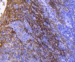 Cytokeratin 13 Antibody in Immunohistochemistry (Paraffin) (IHC (P))