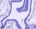 Cytokeratin 13 Antibody in Immunohistochemistry (Paraffin) (IHC (P))