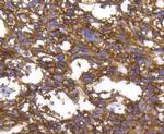 CD49b (Integrin alpha 2) Antibody in Immunohistochemistry (Paraffin) (IHC (P))