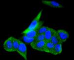 ACE2 Antibody in Immunocytochemistry (ICC/IF)