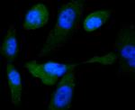 GYS1 Antibody in Immunocytochemistry (ICC/IF)