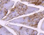 GYS1 Antibody in Immunohistochemistry (Paraffin) (IHC (P))