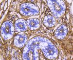 CD13 Antibody in Immunohistochemistry (Paraffin) (IHC (P))