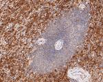 PYCARD Antibody in Immunohistochemistry (Paraffin) (IHC (P))