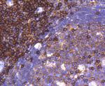 CD38 Antibody in Immunohistochemistry (Paraffin) (IHC (P))