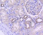 CD38 Antibody in Immunohistochemistry (Paraffin) (IHC (P))