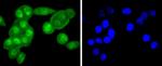 FANCD2 Antibody in Immunocytochemistry (ICC/IF)