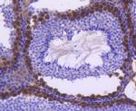 FANCD2 Antibody in Immunohistochemistry (Paraffin) (IHC (P))