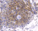 Phospho-PKC zeta (Thr560) Antibody in Immunohistochemistry (Paraffin) (IHC (P))