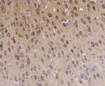 Phospho-PKC zeta (Thr560) Antibody in Immunohistochemistry (Paraffin) (IHC (P))