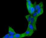 CD10 Antibody in Immunocytochemistry (ICC/IF)